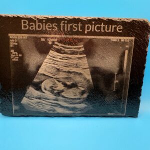 Ultrasound picture