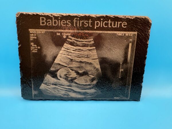 Ultrasound picture